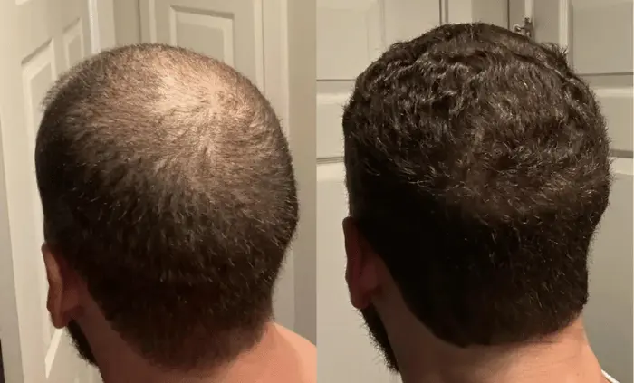 Depoimento de cliente